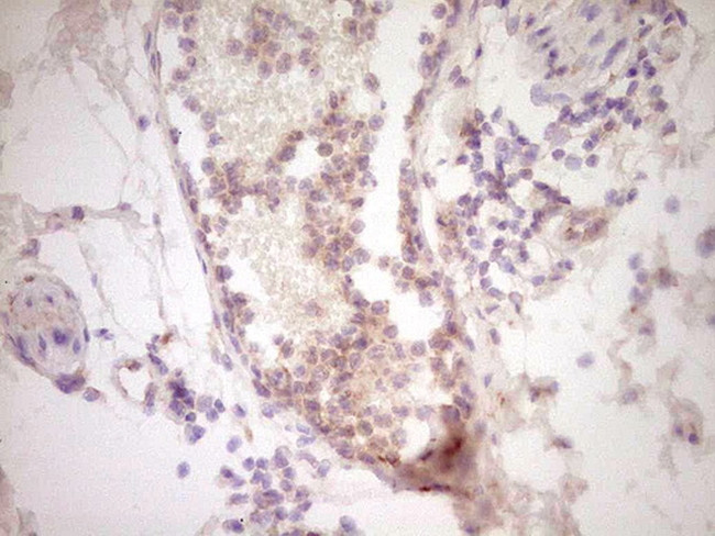 UBE2D2 Antibody in Immunohistochemistry (Paraffin) (IHC (P))