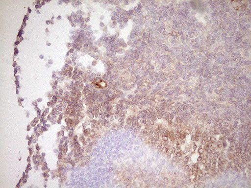 UBE2D2 Antibody in Immunohistochemistry (Paraffin) (IHC (P))