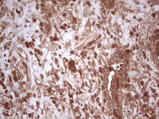 UBE2D2 Antibody in Immunohistochemistry (Paraffin) (IHC (P))