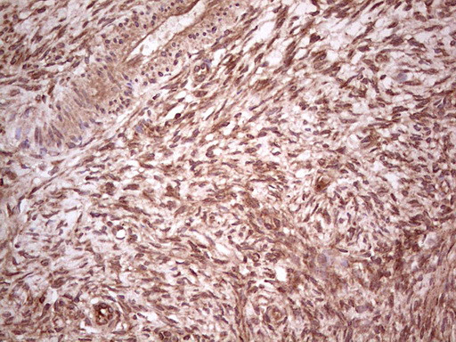 UBE2D2 Antibody in Immunohistochemistry (Paraffin) (IHC (P))