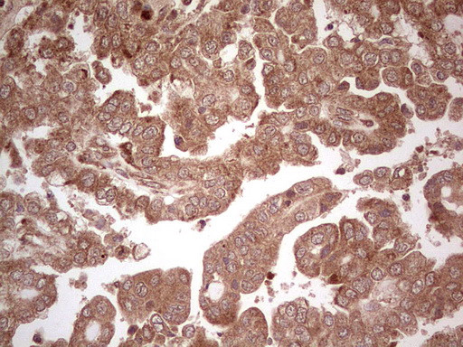 UBE2D2 Antibody in Immunohistochemistry (Paraffin) (IHC (P))