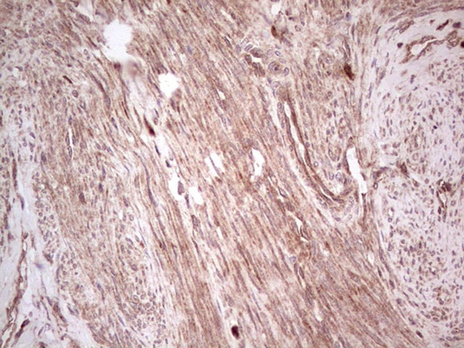 UBE2D2 Antibody in Immunohistochemistry (Paraffin) (IHC (P))