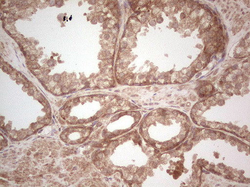 UBE2D2 Antibody in Immunohistochemistry (Paraffin) (IHC (P))