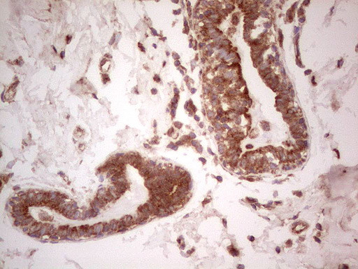 UBE2D2 Antibody in Immunohistochemistry (Paraffin) (IHC (P))