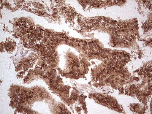 UBE2D2 Antibody in Immunohistochemistry (Paraffin) (IHC (P))