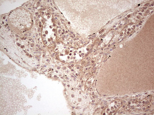 UBE2D2 Antibody in Immunohistochemistry (Paraffin) (IHC (P))