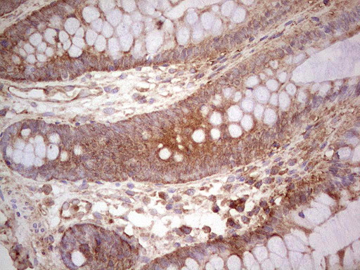 UBE2D2 Antibody in Immunohistochemistry (Paraffin) (IHC (P))