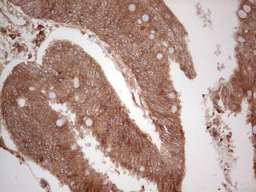 UBE2D2 Antibody in Immunohistochemistry (Paraffin) (IHC (P))