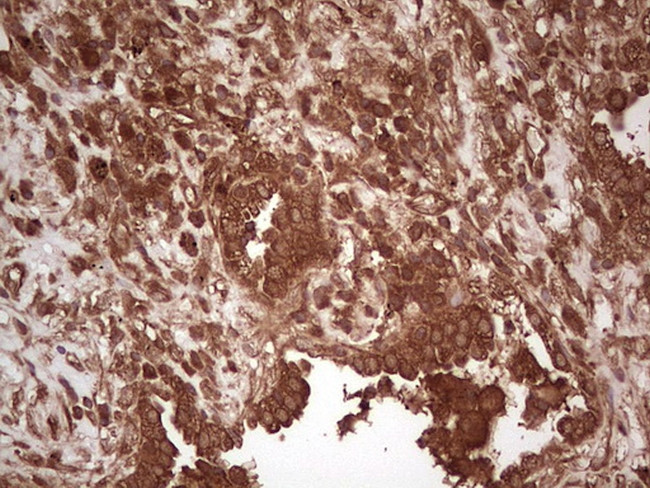 UBE2D2 Antibody in Immunohistochemistry (Paraffin) (IHC (P))