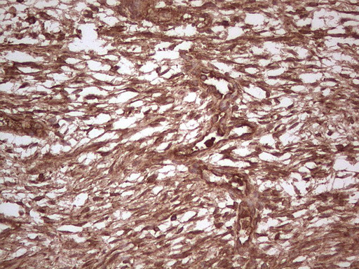 UBE2D2 Antibody in Immunohistochemistry (Paraffin) (IHC (P))