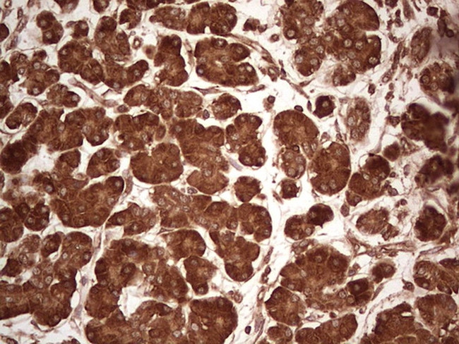 UBE2D2 Antibody in Immunohistochemistry (Paraffin) (IHC (P))