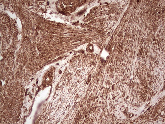 UBE2D2 Antibody in Immunohistochemistry (Paraffin) (IHC (P))