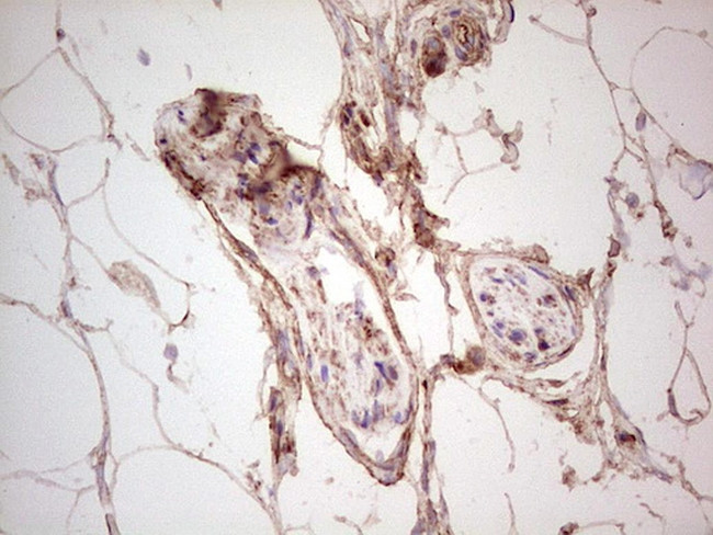 UBE2D2 Antibody in Immunohistochemistry (Paraffin) (IHC (P))