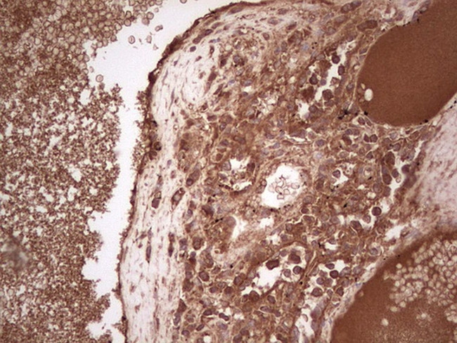 UBE2D2 Antibody in Immunohistochemistry (Paraffin) (IHC (P))