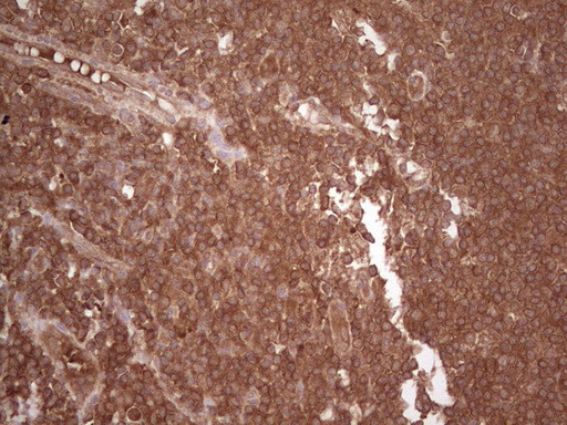 UBE2D2 Antibody in Immunohistochemistry (Paraffin) (IHC (P))