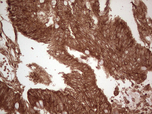 UBE2D2 Antibody in Immunohistochemistry (Paraffin) (IHC (P))