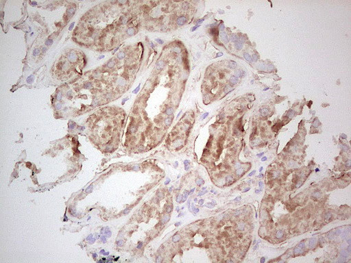 UBE2D2 Antibody in Immunohistochemistry (Paraffin) (IHC (P))