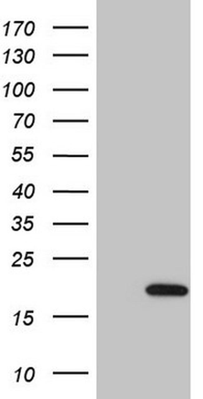 UBE2D2 Antibody in Western Blot (WB)