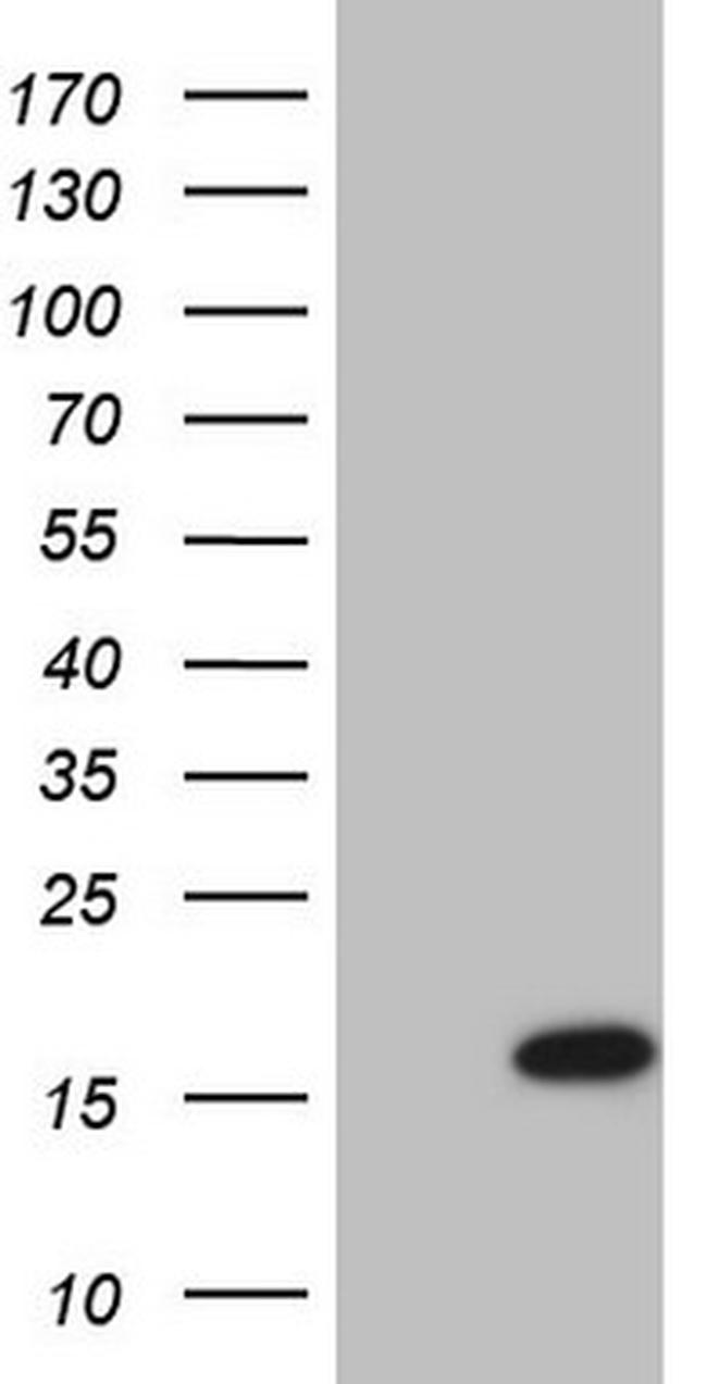 UBE2D2 Antibody in Western Blot (WB)