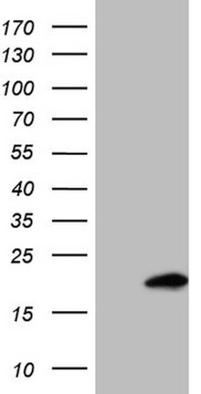 UBE2D2 Antibody in Western Blot (WB)