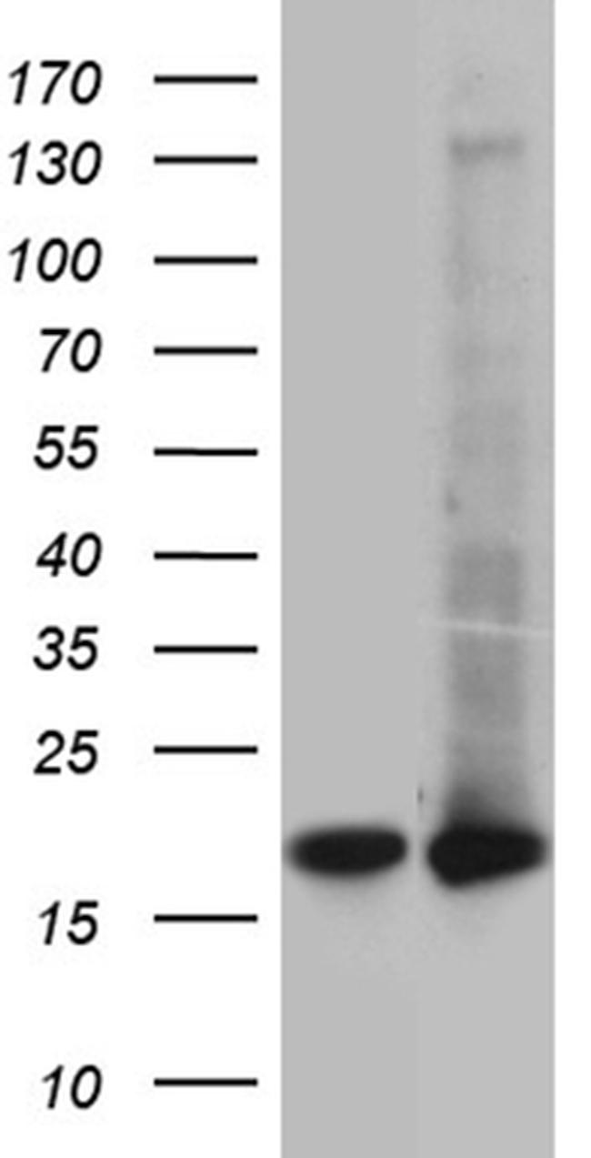 UBE2D4 Antibody in Western Blot (WB)