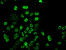 UBE2E3 Antibody in Immunocytochemistry (ICC/IF)