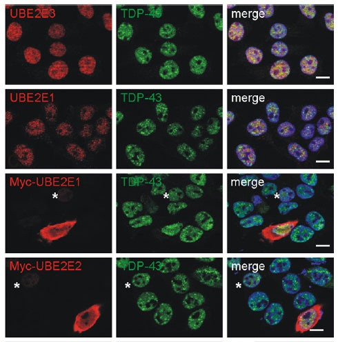 UBE2E3 Antibody in Immunocytochemistry (ICC/IF)