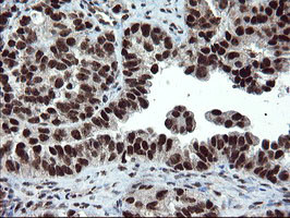 UBE2E3 Antibody in Immunohistochemistry (Paraffin) (IHC (P))