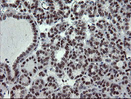 UBE2E3 Antibody in Immunohistochemistry (Paraffin) (IHC (P))