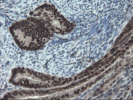 UBE2E3 Antibody in Immunohistochemistry (Paraffin) (IHC (P))