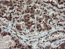 UBE2E3 Antibody in Immunohistochemistry (Paraffin) (IHC (P))