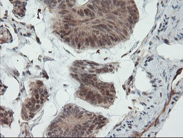 UBE2E3 Antibody in Immunohistochemistry (Paraffin) (IHC (P))