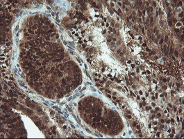 UBE2E3 Antibody in Immunohistochemistry (Paraffin) (IHC (P))