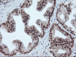 UBE2E3 Antibody in Immunohistochemistry (Paraffin) (IHC (P))