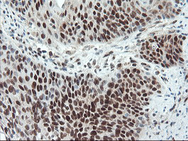 UBE2E3 Antibody in Immunohistochemistry (Paraffin) (IHC (P))