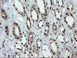 UBE2E3 Antibody in Immunohistochemistry (Paraffin) (IHC (P))