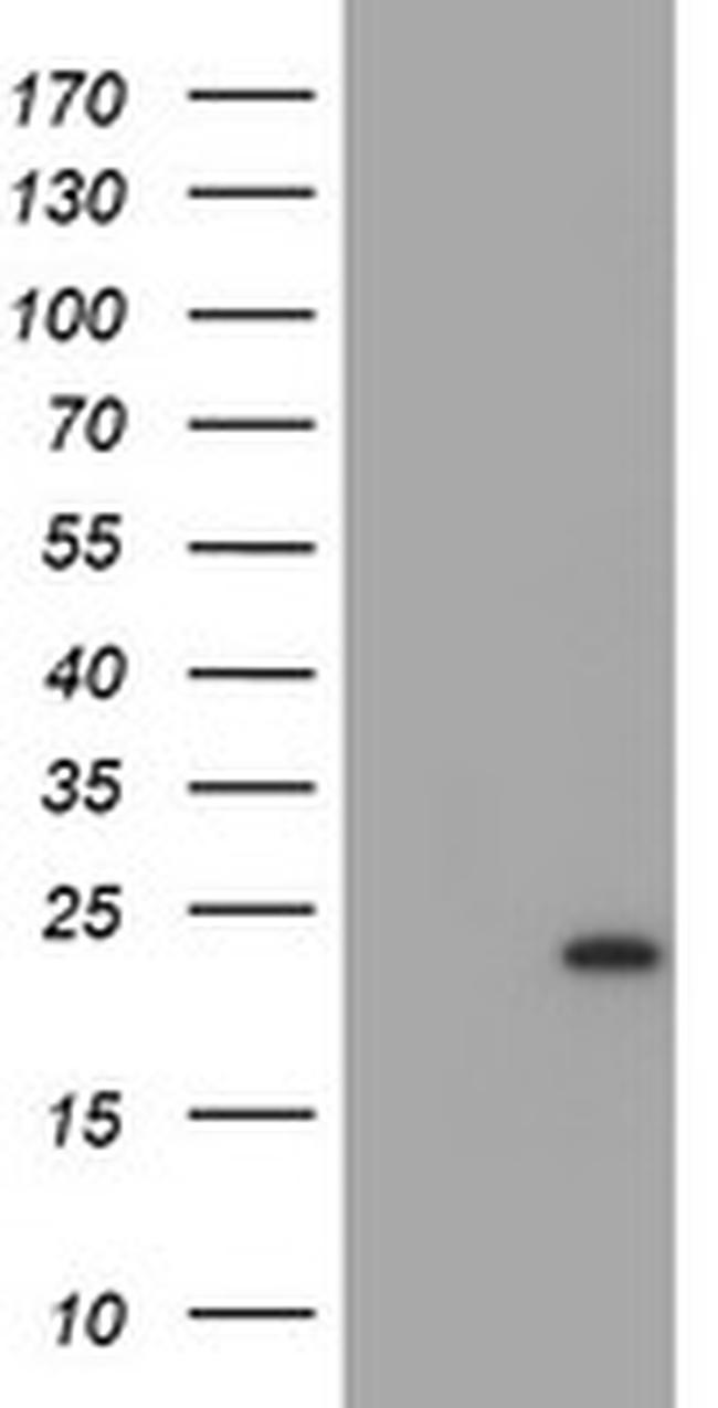 UBE2E3 Antibody in Western Blot (WB)