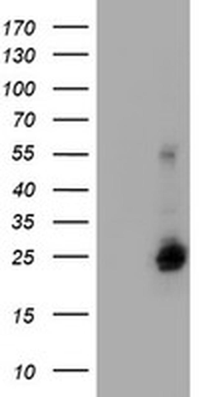 UBE2E3 Antibody in Western Blot (WB)