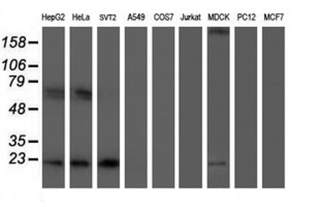 UBE2E3 Antibody in Western Blot (WB)