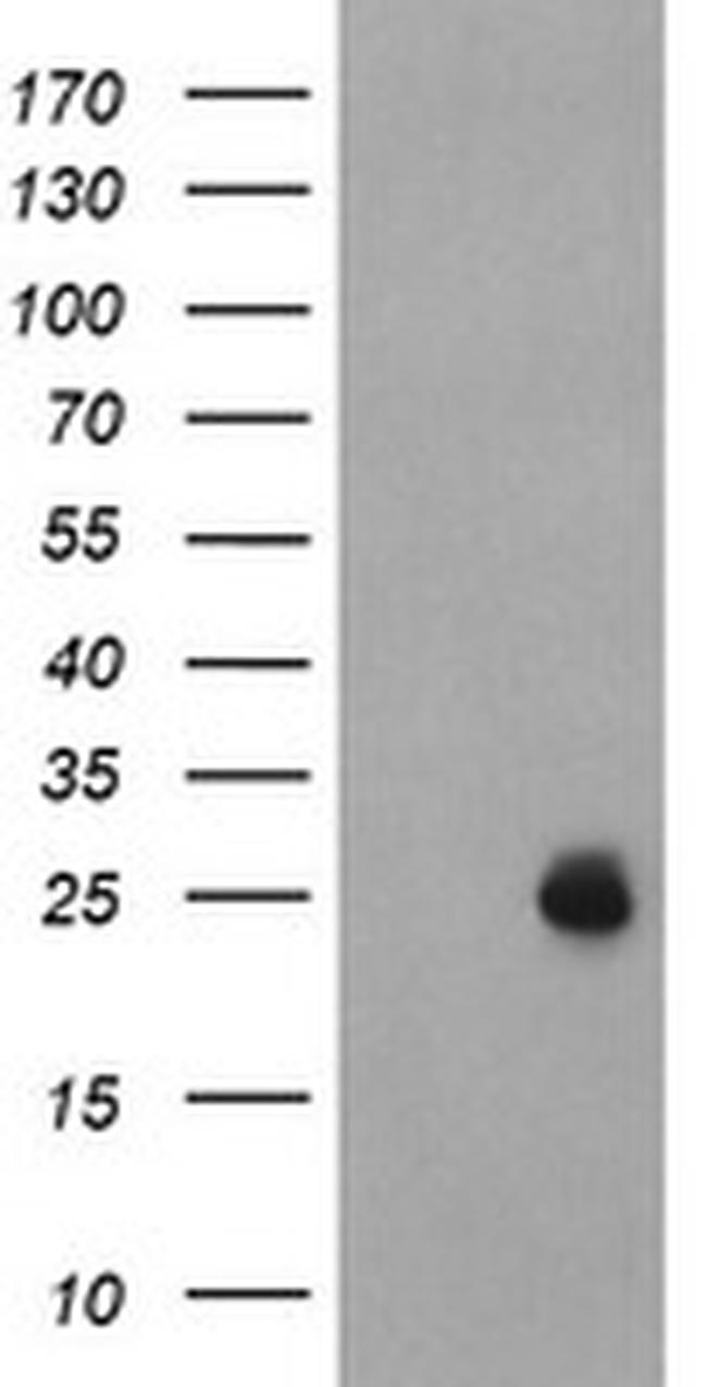 UBE2E3 Antibody in Western Blot (WB)