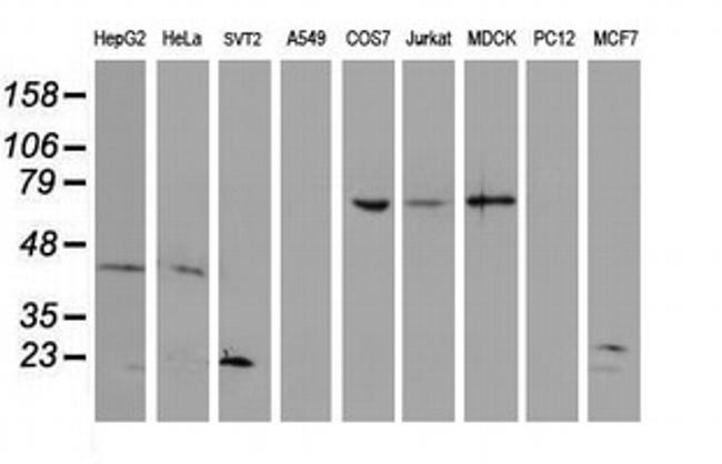 UBE2E3 Antibody in Western Blot (WB)