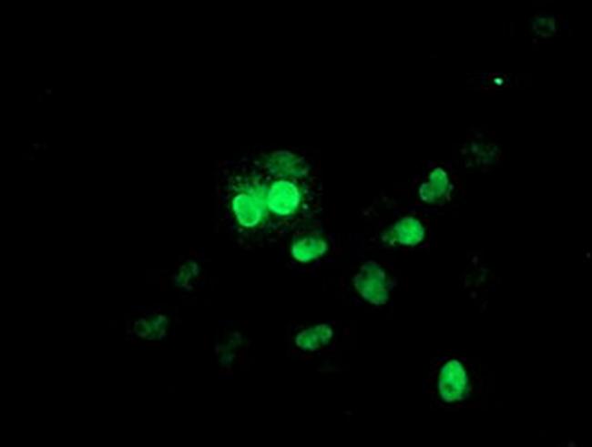 UBE2E3 Antibody in Western Blot (WB)