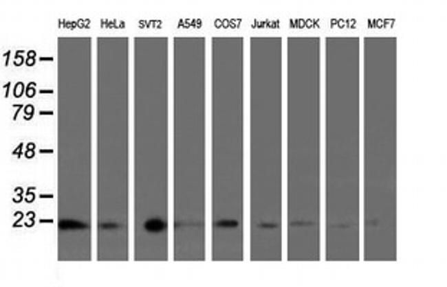 UBE2E3 Antibody in Western Blot (WB)