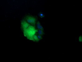 UBE2G2 Antibody in Immunocytochemistry (ICC/IF)