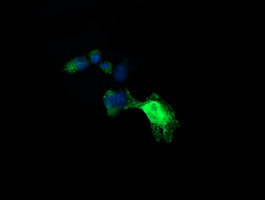 UBE2G2 Antibody in Immunocytochemistry (ICC/IF)