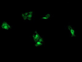 UBE2G2 Antibody in Immunocytochemistry (ICC/IF)