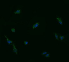 UBE2G2 Antibody in Immunocytochemistry (ICC/IF)