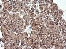 UBE2G2 Antibody in Immunohistochemistry (Paraffin) (IHC (P))