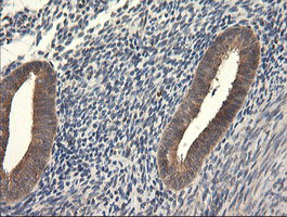 UBE2G2 Antibody in Immunohistochemistry (Paraffin) (IHC (P))