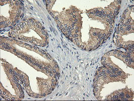 UBE2G2 Antibody in Immunohistochemistry (Paraffin) (IHC (P))